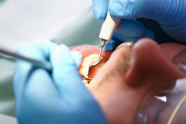 Best Emergency Broken Tooth Repair in Palestine, TX