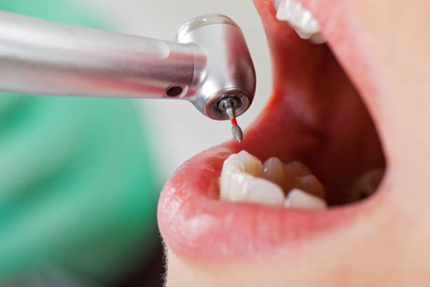 Best Emergency Treatment for Toothache in Palestine, TX